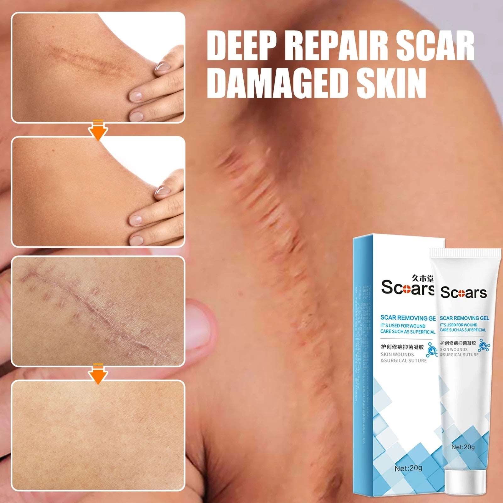 New Herbal Scar Repair Cream 724GoShop