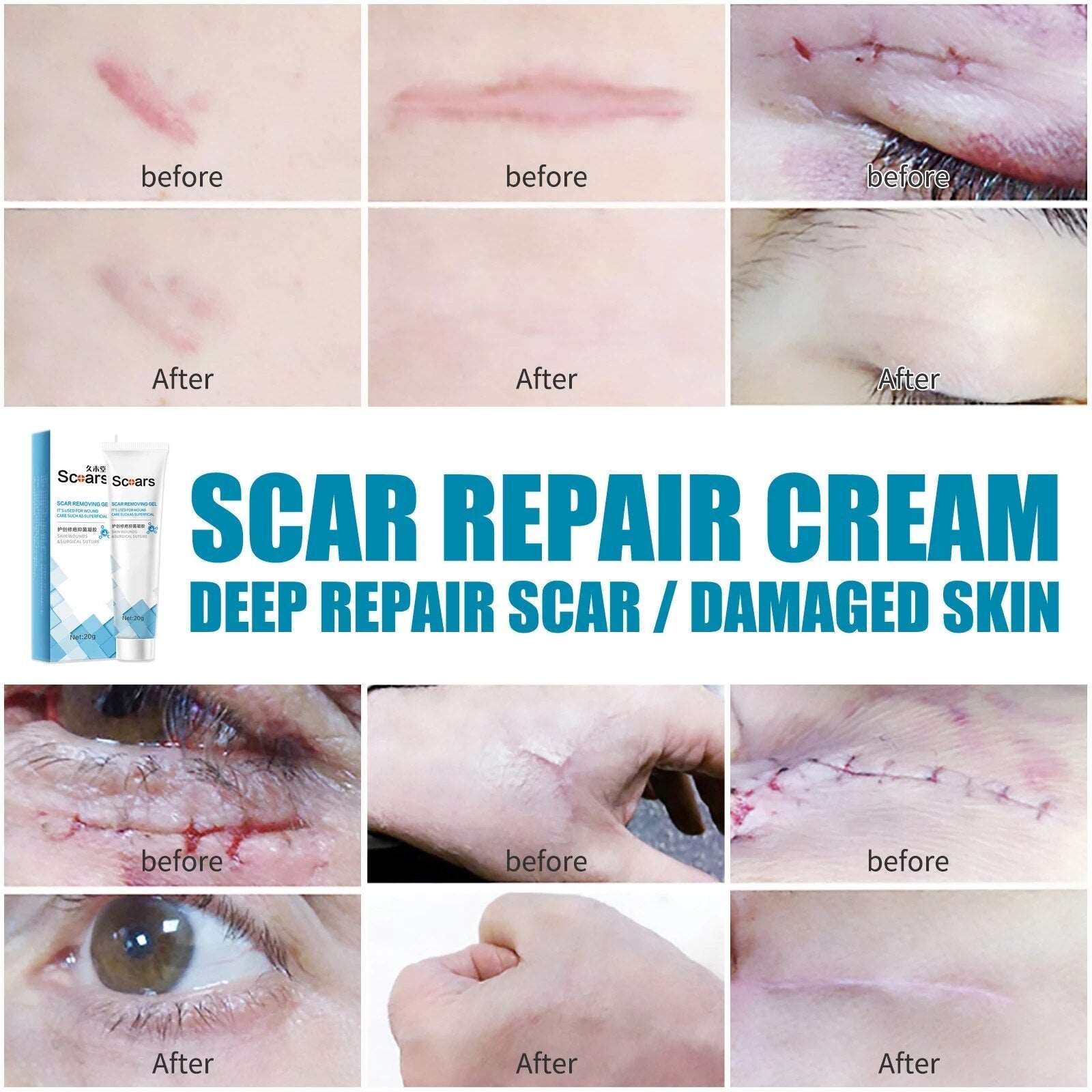 New Herbal Scar Repair Cream 724GoShop