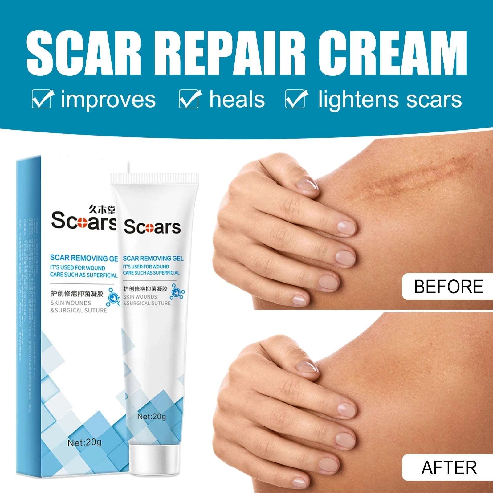 New Herbal Scar Repair Cream Default Title 724GoShop