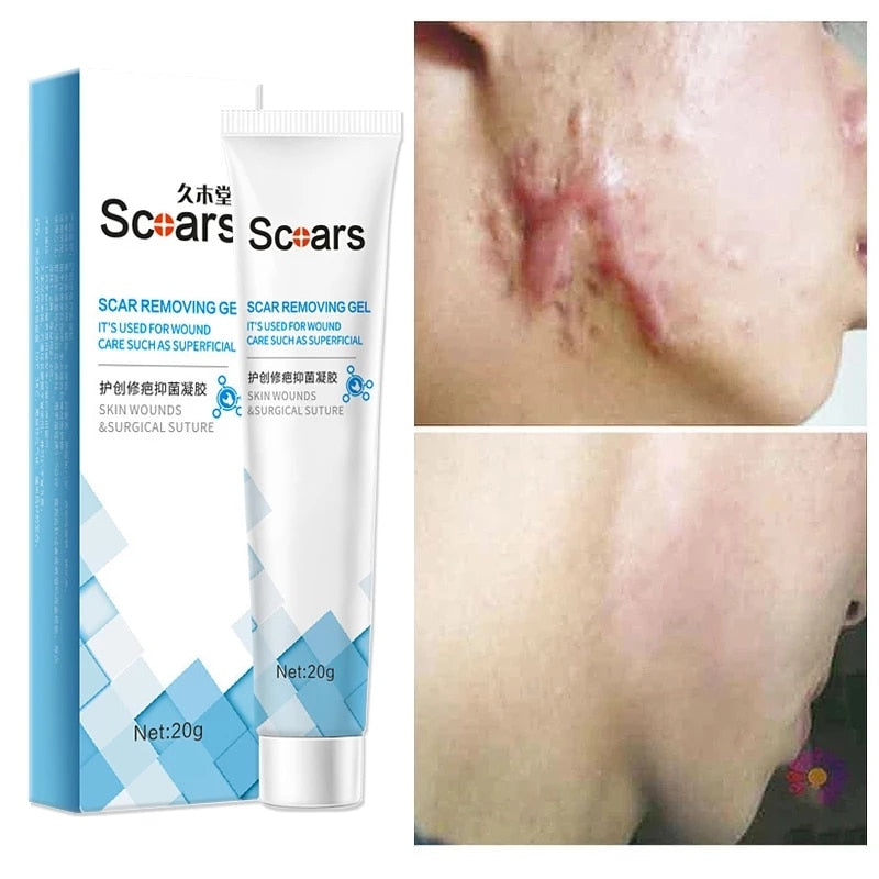 New Herbal Scar Repair Cream 724GoShop