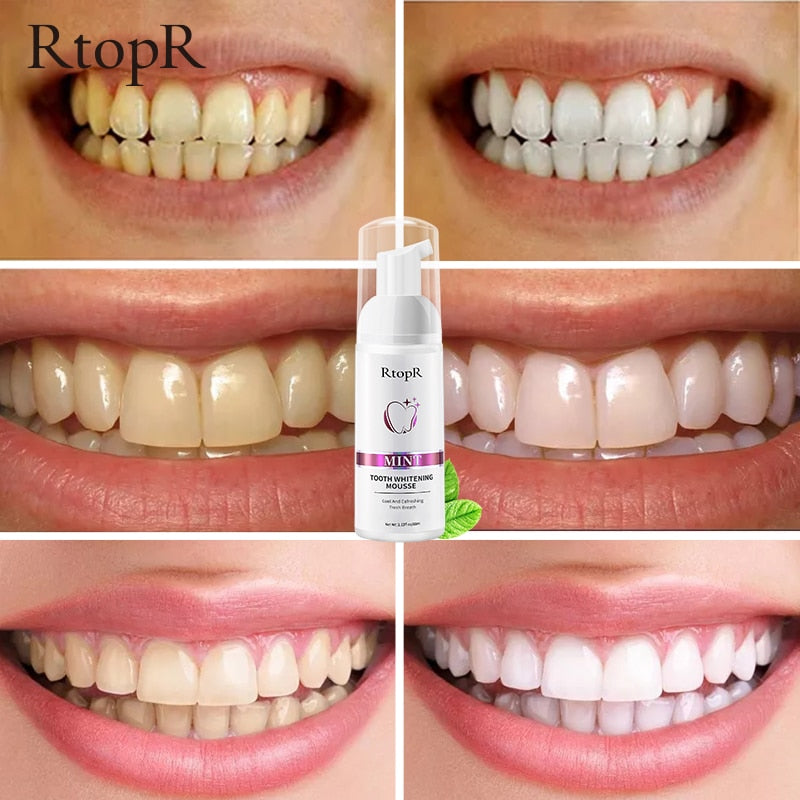 Tooth Whitening Mousse 724GoShop