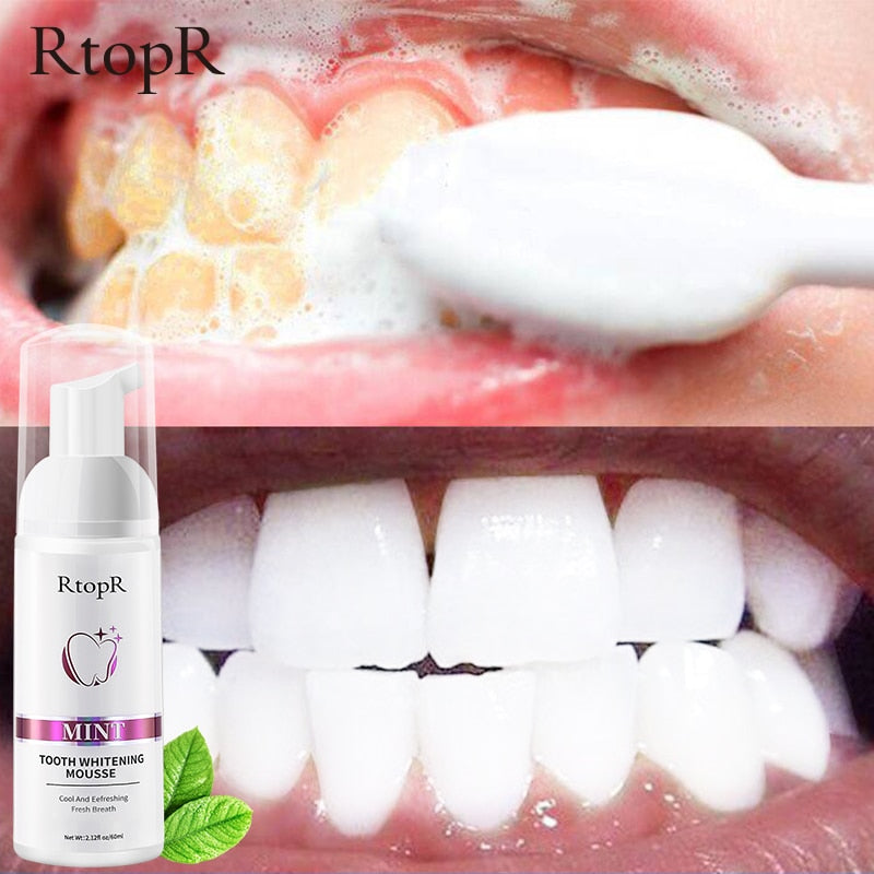 Tooth Whitening Mousse 724GoShop